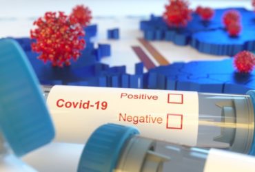 covid-19-un-adr-acisindan-degerlendirilmesi