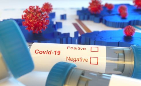 covid-19-un-adr-acisindan-degerlendirilmesi