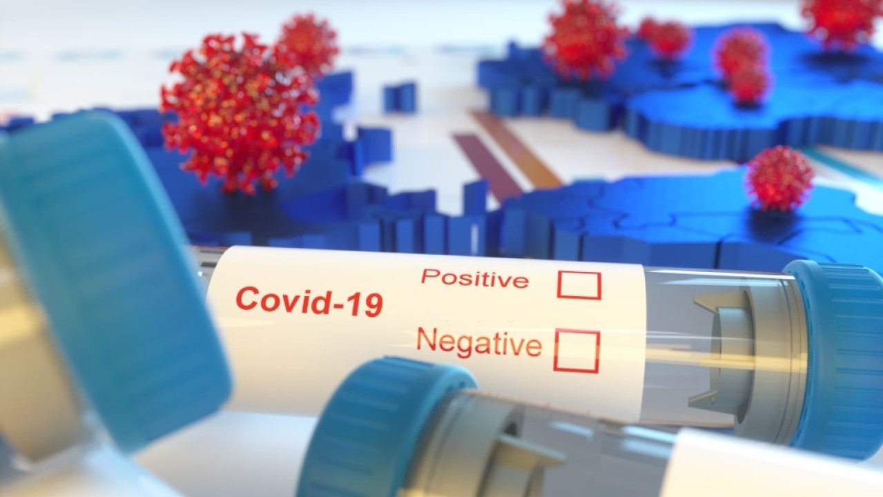 covid-19-un-adr-acisindan-degerlendirilmesi